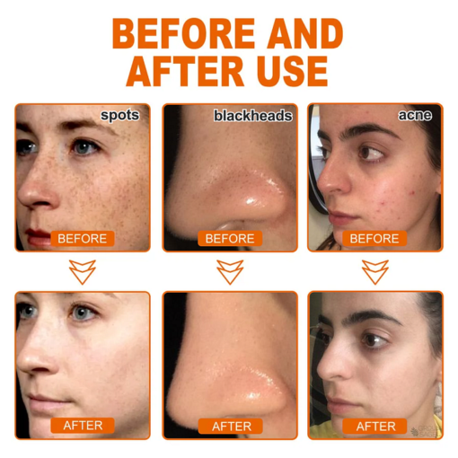 BQYOOM Herbal Spots Peel-Off Facial Mask - Image 2