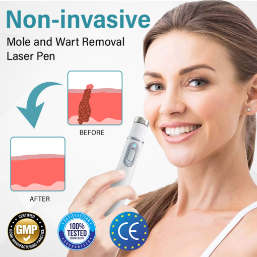BQYOOM™ MoleLaser Painless Laser Mole Removal Pen - Image 4