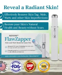 BQYOOM™ FlawZapper Mole and Wart Removal Laser Pen