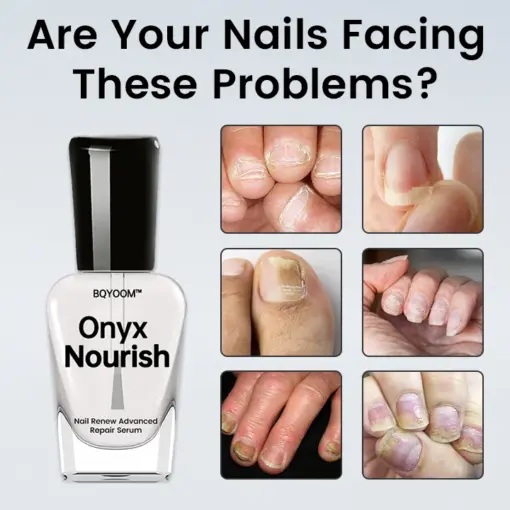 BQYOOM® Onyx Nourish Nail Renew Advanced Repair Serum - Image 2