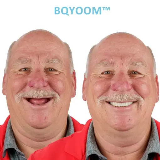 BQYOOM™ GelFit Dentures - Image 3