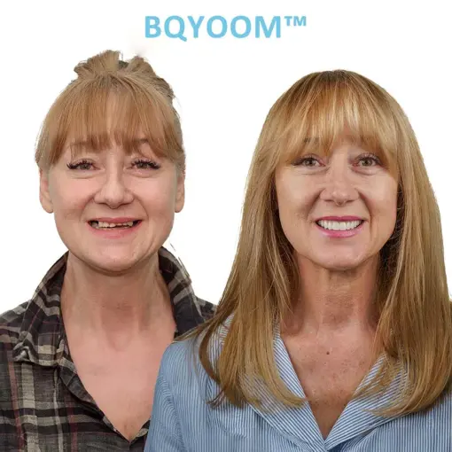BQYOOM™ GelFit Dentures - Image 4