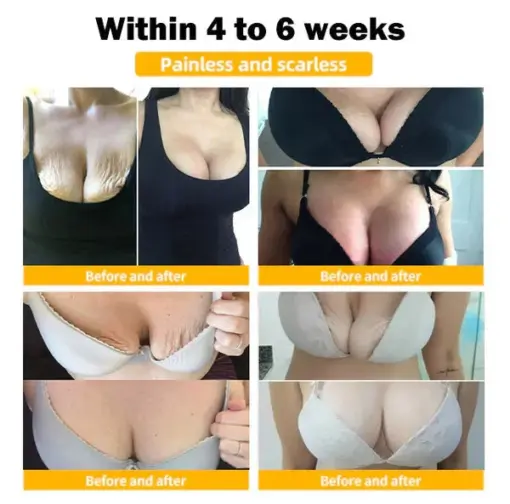 BQYOOM™ 100% Natural Sagging Repair Patch or Breast Enhancement Patch - Image 4
