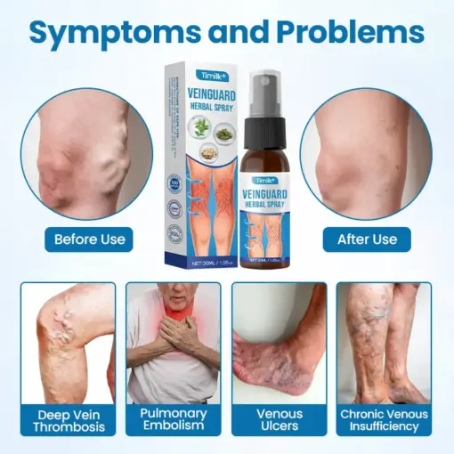 BQYOOM™ VeinGuard Herbal Spray - Image 3