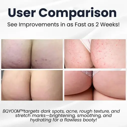 BQYOOM™ Butt Skin Treatment Cream - Image 2