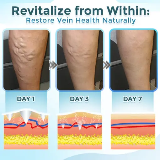 BQYOOM™ VenaRestore MicroNeedle Vein Repair Patch - Image 3