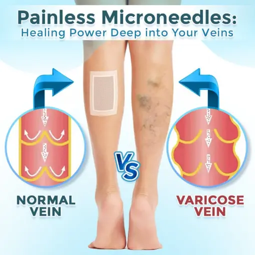BQYOOM™ VenaRestore MicroNeedle Vein Repair Patch - Image 2