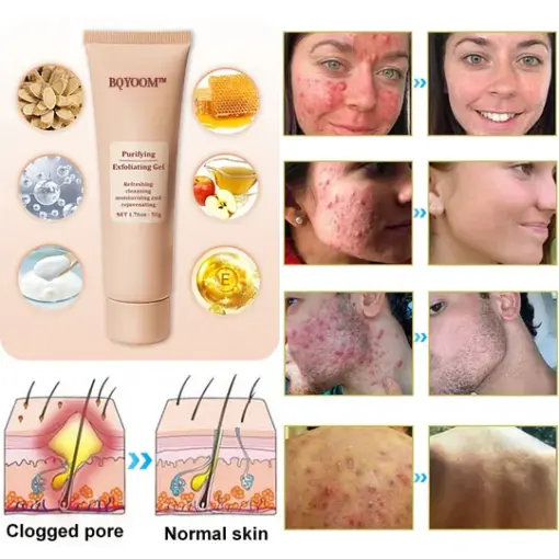 BQYOOM™ Purifying Exfoliating Gel - Image 4