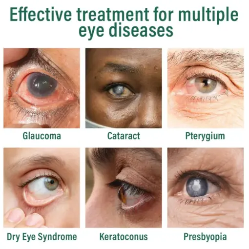 BQYOOM™ Nano Eye Drops Serum - Image 3