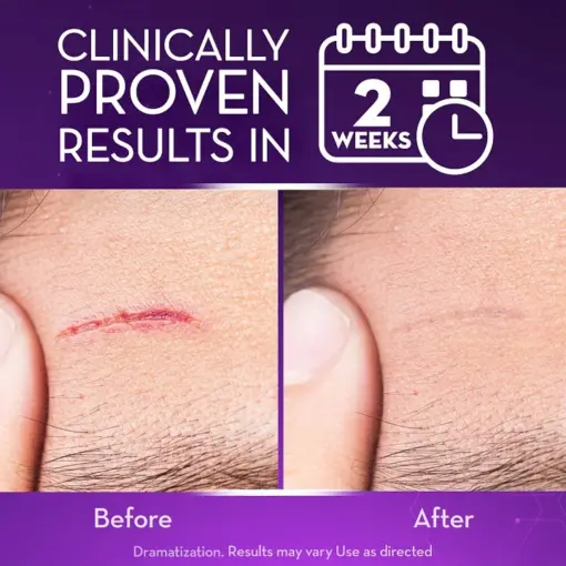 BQYOOM™ Advanced Scar Gel - Image 4