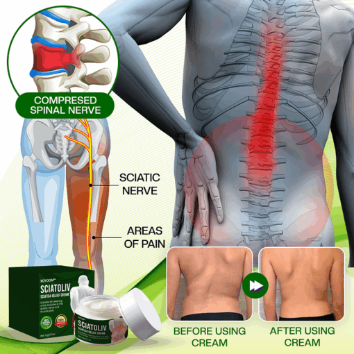 BQYOOM™ Sciatoliv Sciatica Relief Cream - Image 4