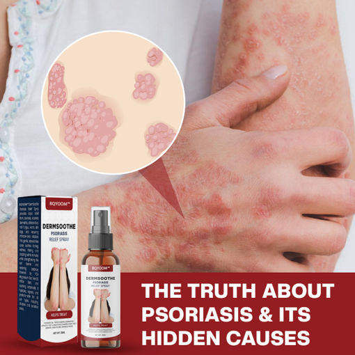 BQYOOM™ DermSoothe Psoriasis Relief Spray - Image 4