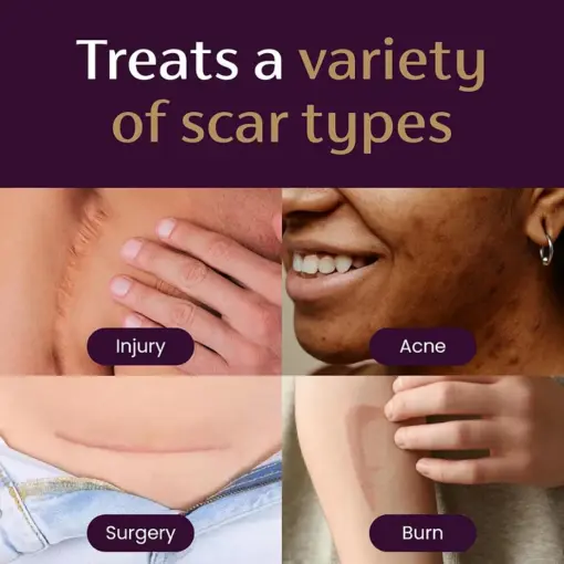 BQYOOM™ Advanced Scar Gel - Image 2