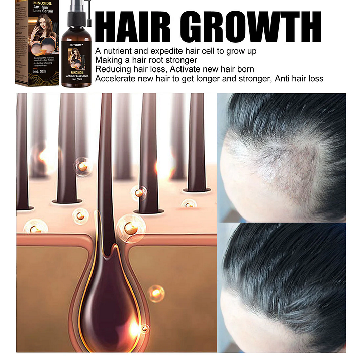 BQYOOM™ Rapid Hair Regrowth Oil - Image 3