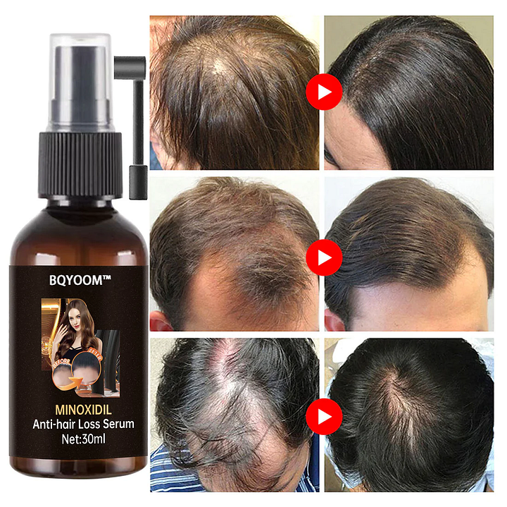 BQYOOM™ Rapid Hair Regrowth Oil - Image 2