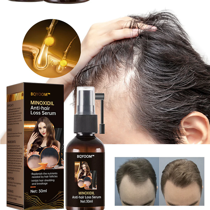 BQYOOM™ Rapid Hair Regrowth Oil - Image 4