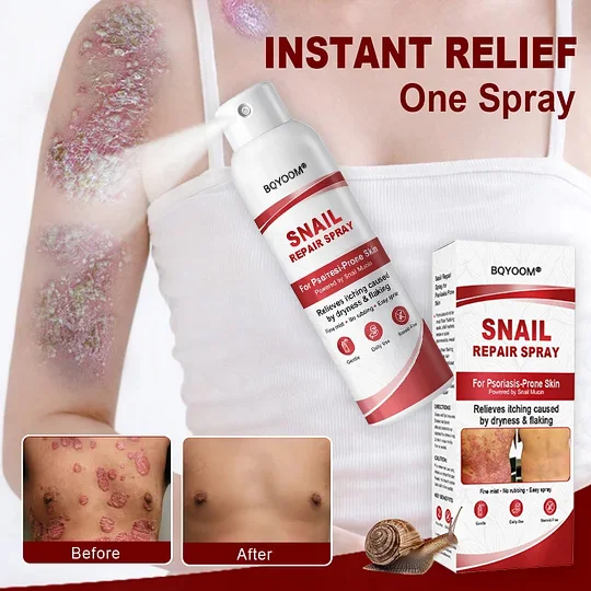 BQYOOM® Snail Repair Spray - Image 2